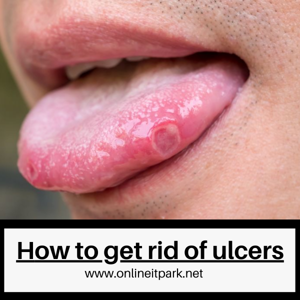 How to get rid of ulcers (1).png